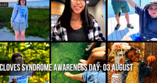 Cloves Syndrome Awareness Day: Theme, History, Significance