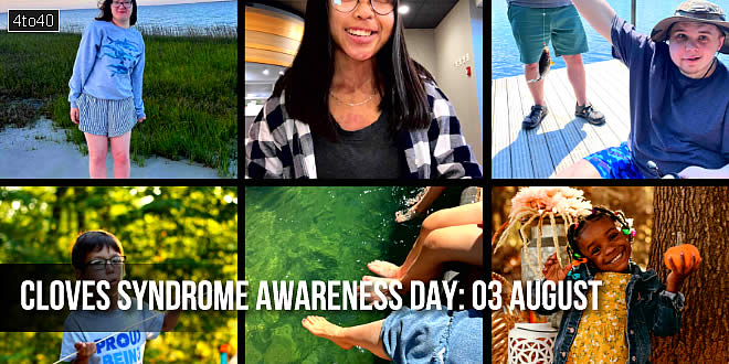 Cloves Syndrome Awareness Day: Theme, History, Significance